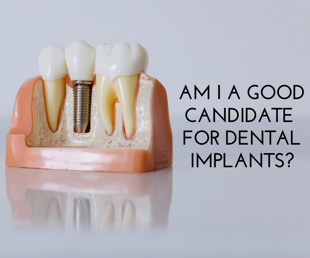 Am I A Good Candidate For Dental Implants